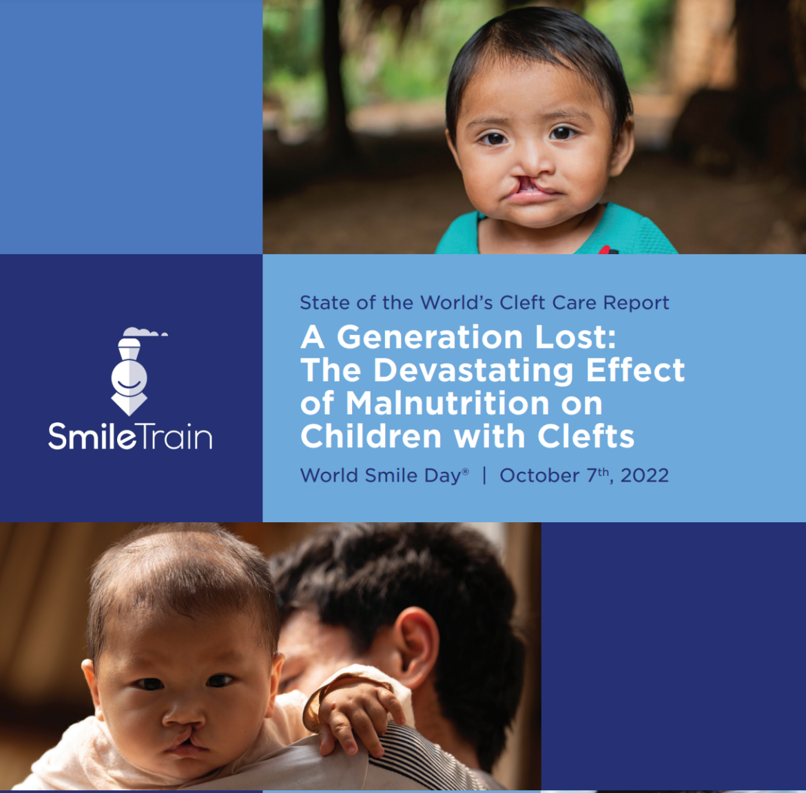 policyreport_smiletrain-cleft_2022